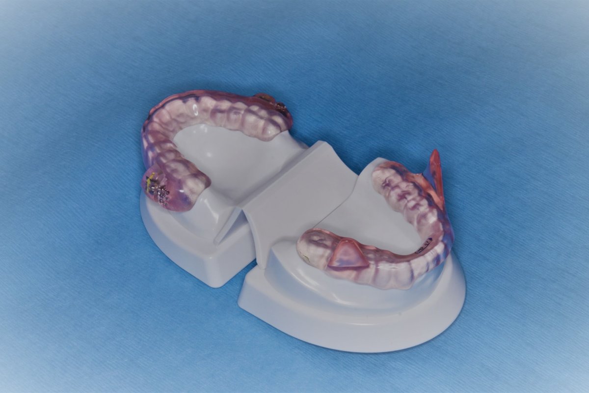 Schnarchsiene (Somodent)